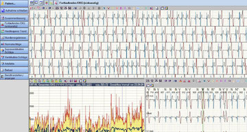 Auswertung eines 24h-EKG