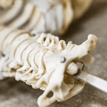 Welche Physiotherapie nach Wirbelsäulen Versteifung?