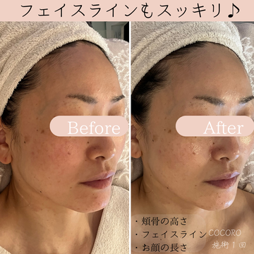 整形いらず!ビフォーアフター