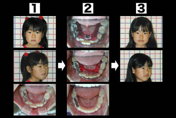 Case2 子どもの成長発育