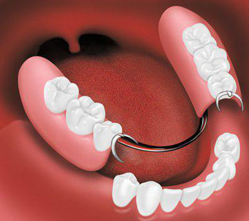 Life With Dentures - 99Designs-584Dbea7E6Ea6