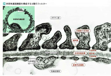 糸球体濾過障壁を構成するフィルター