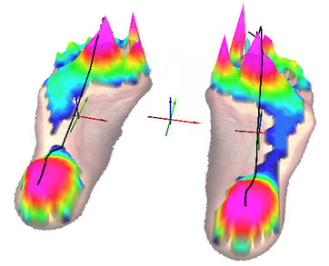 Superimposed representation of dynamic pressure measurement and insert in 3D view and curve