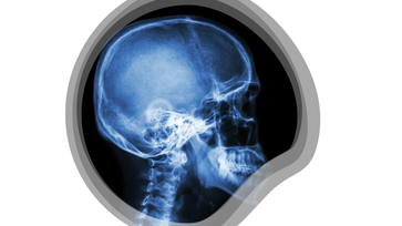 X-ray of a Successful Small Medium Business (SMB) Digital Workplace Strategy
