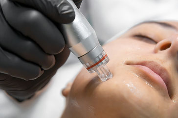 Aquafacial Treatment in Basel