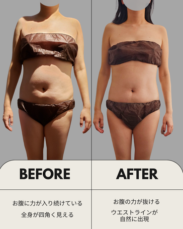 筋膜　ビフォーアフター