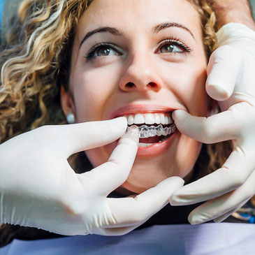 Schöne Zähne durch Aligner Zahnarztpraxis Dr. Becker Zürich
