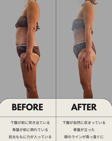 ファシア　ビフォーアフター
