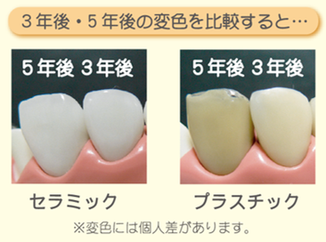 八戸市　くぼた歯科医院　セラミック　ホワイトニング　オススメ　安い