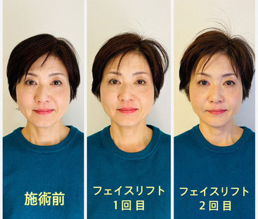 アクセス・バーズ アクセスコンシャスネス ボディ