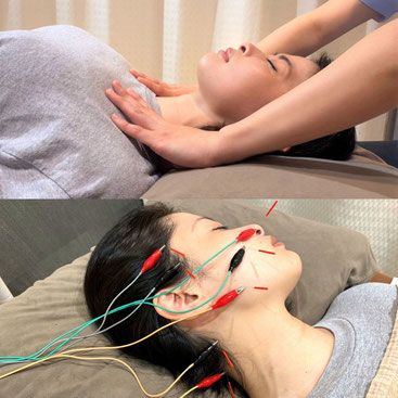 美容パルス鍼 - 星のアカリ治療院-東神奈川の美容鍼・整体