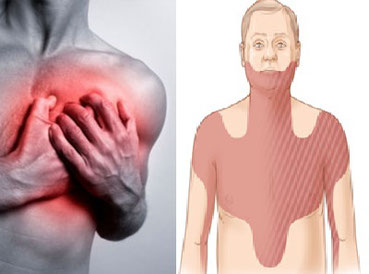 estudios para saber si tengo angina de pecho estudios para saber si tengo angina de pecho