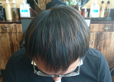 薄毛克服体験記ブログ9月27日の店長の頭頂部写真