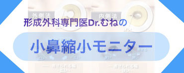 形成外科専門医・Dr.むねは、小鼻縮小モニターさんを大募集しております。