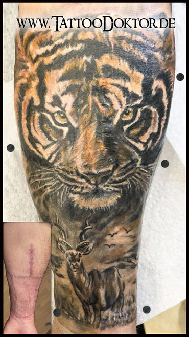 Tattoo Rostock, Narbencover, CoverUp Narbe Tiger, TattooRitual dein Tattoodoktor