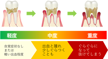 八戸市　歯医者　歯周病　歯茎　くぼた歯科　