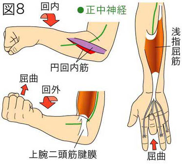 肘部　正中神経障害　誘発テスト