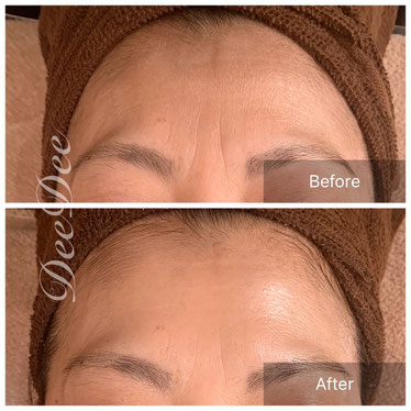 美zen筋骨フェイシャルお客様before after