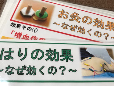 小牧 鍼灸 はり治療 自律神経 腰痛 肩こり 頭痛
