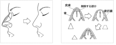 千葉の美容外科ならサンライズ美容外科へ