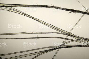Fibre de lin (microscope oculaire)