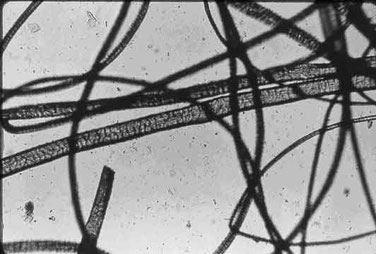 Fibres de laine observées au microscope optique