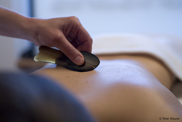 Gua Sha Zürich Kriens