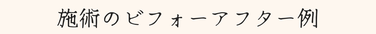 施術のビフォーアフター例