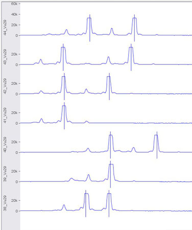 Electropherogram of the marker Vu29