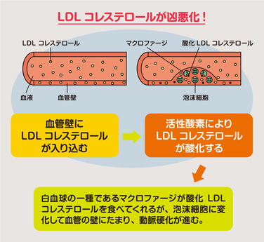 活性酸素によりLDLが酸化