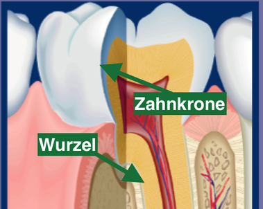 Zahn mit Zahnkrone und Wurzel