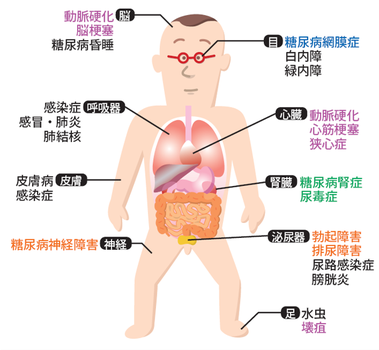 糖尿病の合併症