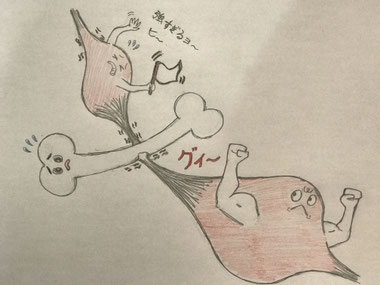 筋肉が骨格を歪ませるイメージのイラスト