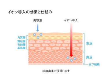 ハイフイオン導入の構図