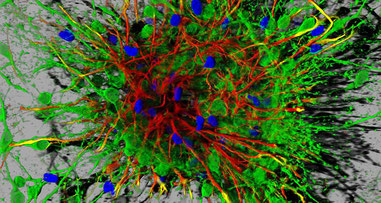 Neurones générés à partir de cellules souches embryonnaires de souris. Image réalisée dans l'équipe Thérapies cellulaires dans les maladies du cerveau (LNEC,université de Poitiers)..
