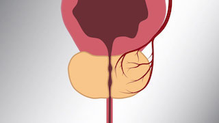 rdv prostate toate simptomele posibile ale prostatitei