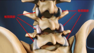 腰痛　トリガーポイント　鍼　鍼灸　筋膜　痛み　松戸　脊柱管狭窄