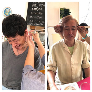 耳ツボは痛かった!頭がお疲れの方には、ちょっと宇宙人ぽくなってしまいますが(笑)