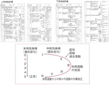 片麻痺　機能　テスト　検査　上田式12段階　ブルンストローム・ステージ　評価　アセスメント　マヒ回復リハビリ教室きゃっちぼーる