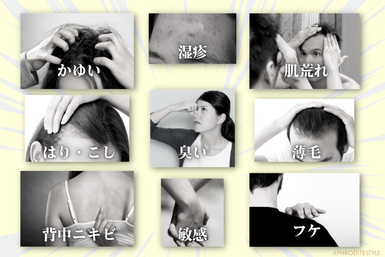 フケかゆみ・脂漏性湿疹アトピーに効果のある無添加全身シャンプー、皮膚刺激の比較グラフ