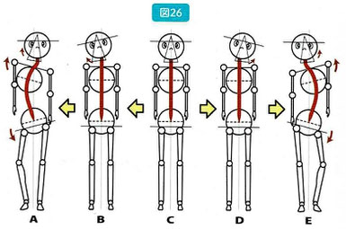 噛み締めによる肩、骨盤の歪み