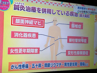 小牧 鍼灸 腰痛 更年期