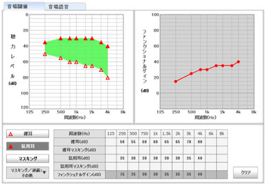 音場閾値測定結果サンプル