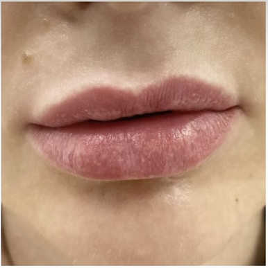 Russian Lip
