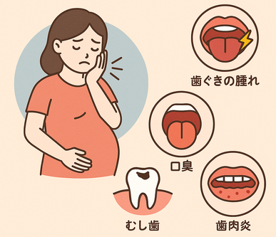 妊娠中に歯ぐきが腫れたり出血しやすくなる口腔内の変化を示すイラスト