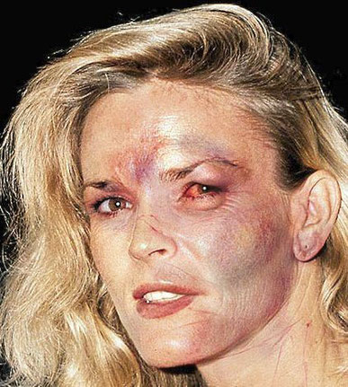 Nicole Brown Simpson, verprügelt