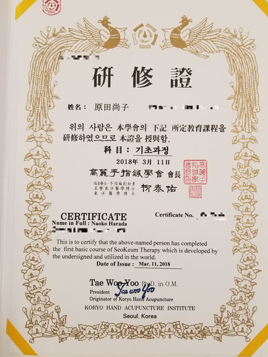 てのひらツボ療法: 高麗手指鍼の原理と応用 柳恭佑著 488503048X 高麗手指