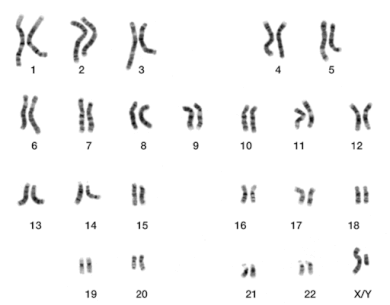 Karyogramm Mann, Quelle: https://upload.wikimedia.org/wikipedia/commons/2/21/DNA_human_male_chromosomes.gif