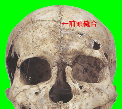 前頭縫合:縄文時代人骨