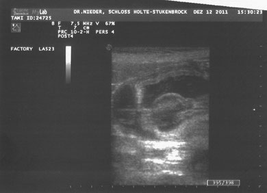 Ultraschall von einem Welpen